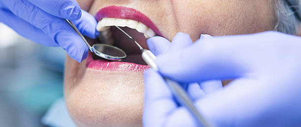 Best Emergency Wisdom Teeth Removal in North Eagle Butte, SD