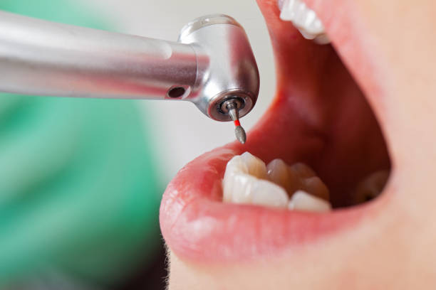 Best Weekend Emergency Dentist in North Eagle Butte, SD
